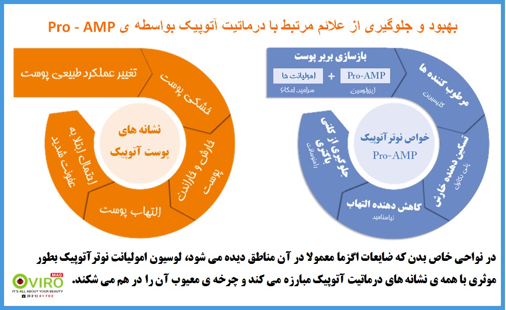 کرم امولیانت نوترآتوپیک ایزدین