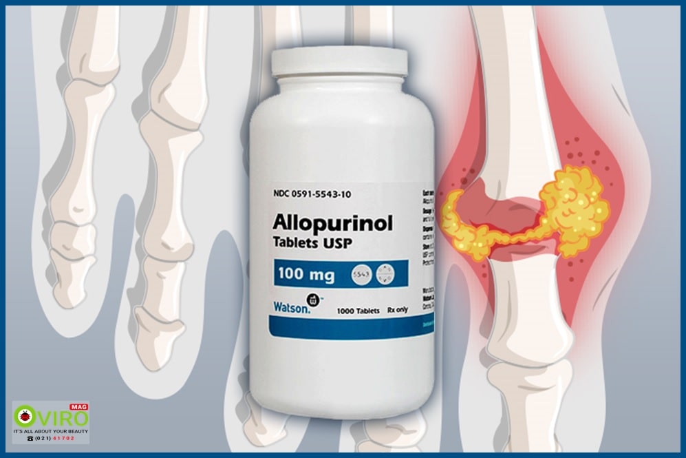 Allopurinol - آلوپورینول | قرص آلوپورینول 100 | دشمن اسید اوریک خون | بهترین زمان مصرف آلوپورینول