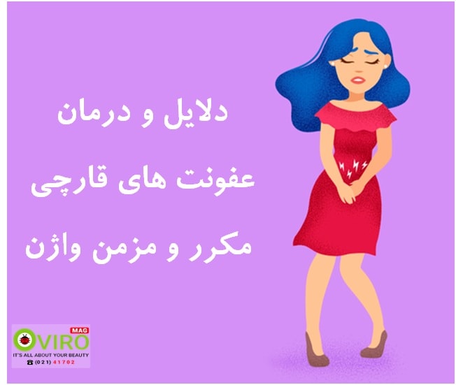 عفونت مخمری یا قارچی مکرر واژن