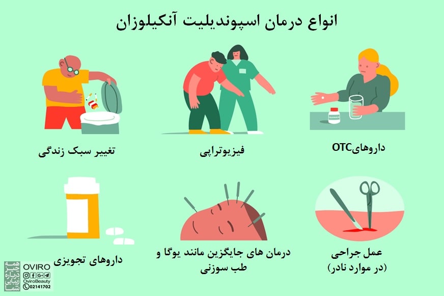 اسپوندیلیت آنکیلوزان (AS) : آزمایش - روش های تشخیص و درمان | درد مزمن مفاصل | آرتریت