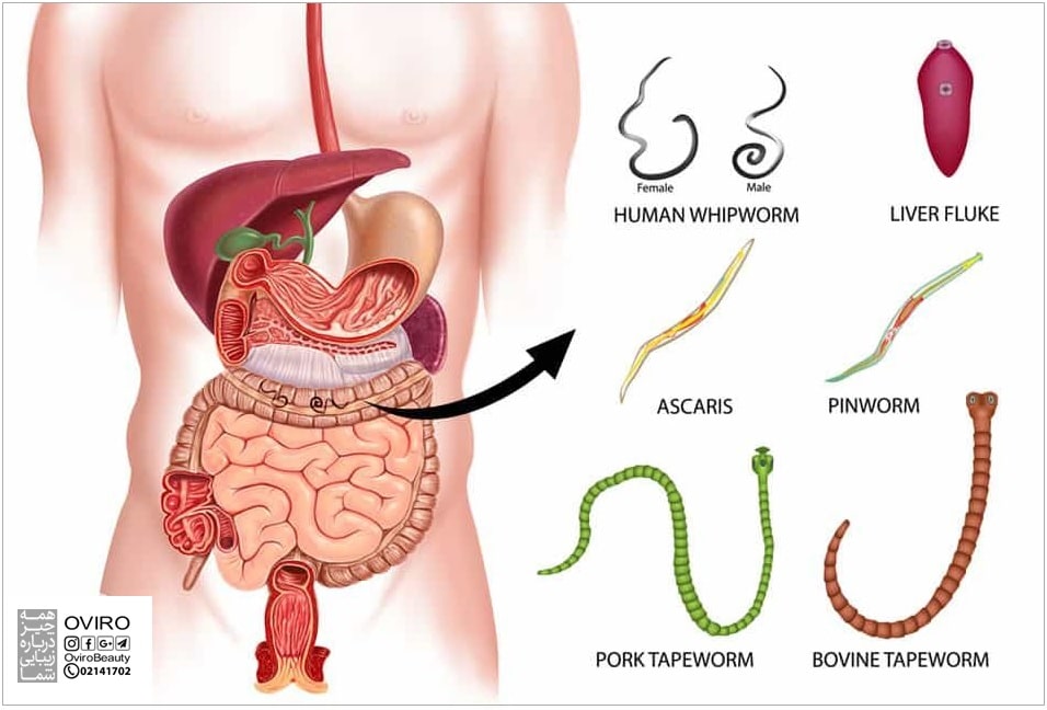 کرم در مدفوع انسان : انواع - زمان مراجعه به پزشک - پیشگیری از عفونت کرم روده | درمان کرم
