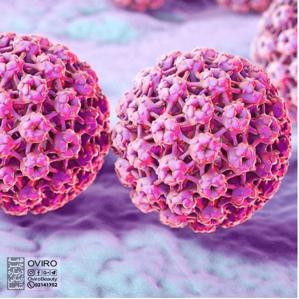 HPV در زنان : علائم - آزمایش و تشخیص - راه های انتقال درمان | ویروس پاپیلومای انسانی