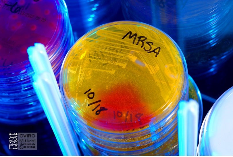 MRSA / استافیلوکوک اورئوس مقاوم به متی ‌سیلین چیست؟ علائم - علت - درمان - تشخیص