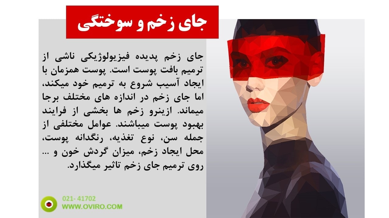 ترمیم جای زخم ، سوختگی و لیزر