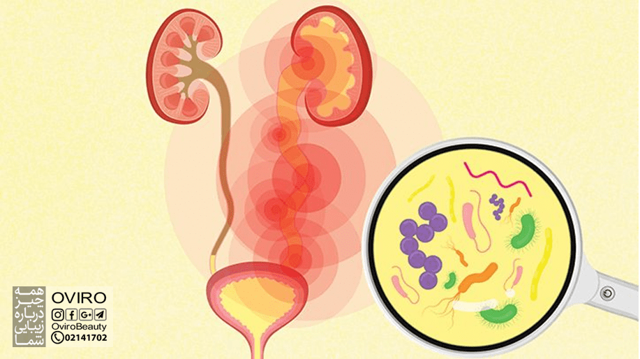 علائم عفونت مثانه کدامند؟ در کودکان - بزرگسالان (زنان و مردان) - افراد مسن - بارداری | درمان